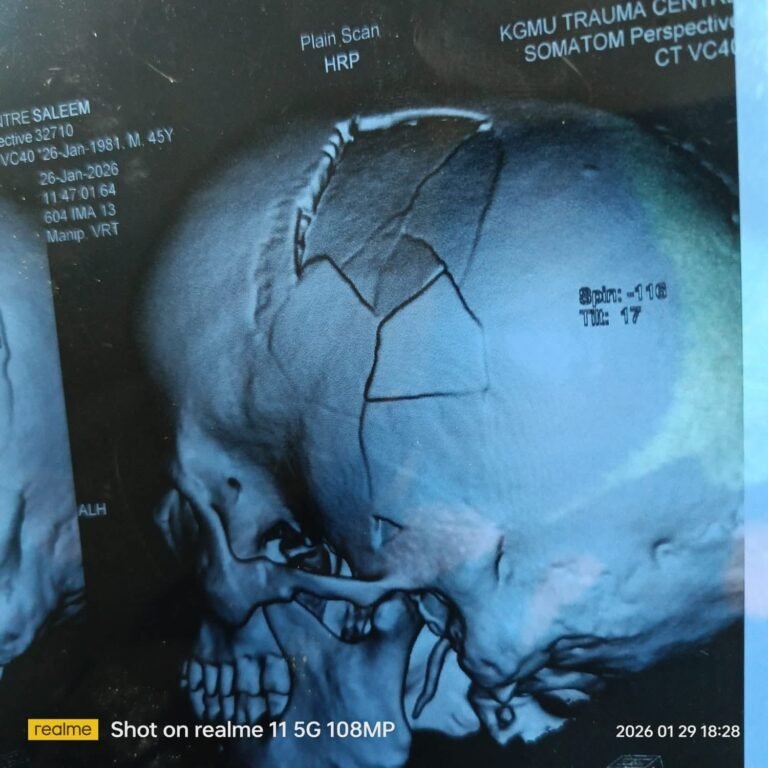 हरदोई : कछौना हिंसा मामला: गंभीर हमले में युवक ICU में भर्ती, CT स्कैन रिपोर्ट ने खोली बर्बरता की परतें
