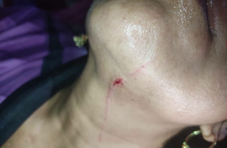 फर्रुखाबाद खाना बनाती महिला पर मुस्लिम समाज के लड़के ने धारदार हथियार से किया हमला आरोपी फरार पुलिस जांच में जुटी