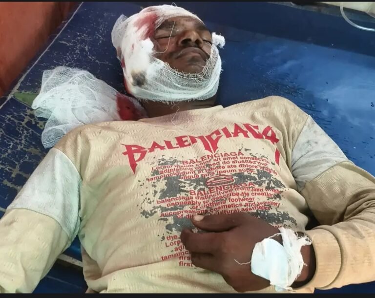 गंगा एक्सप्रेस के पास अज्ञात वाहन की टक्कर से मजदूरी करने निकले युवक की मौत दोस्त गंभीर घायल